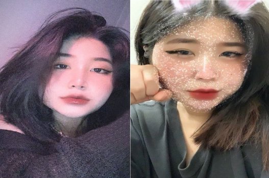 Một cú đạp vào mu ẩn kịch thích